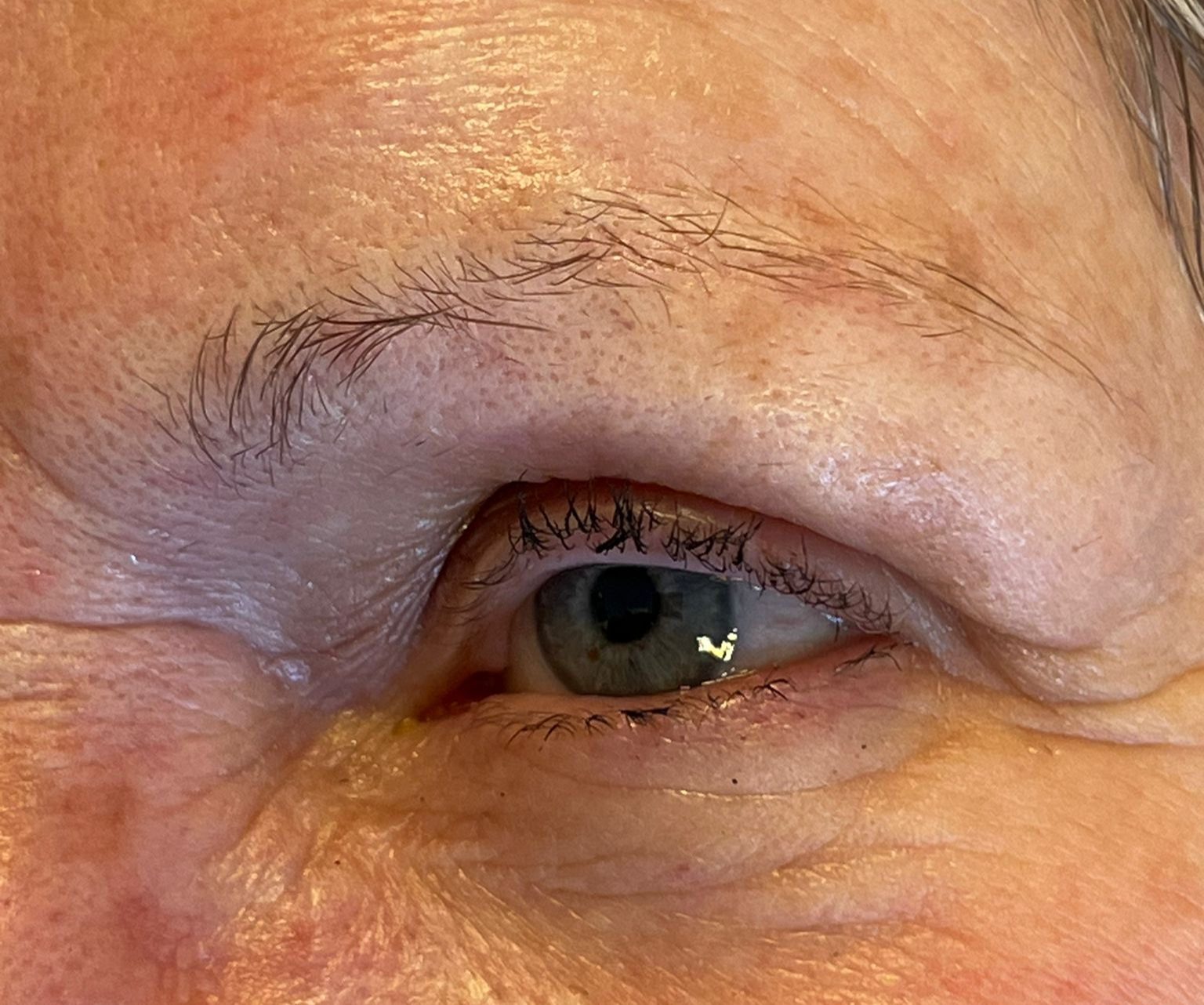 Avant : un sourcil aux poils épars.